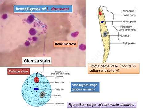  Leishmaniose! Un Parasite Microscopique Qui Provoque Une Maladie Inflammatoire Chez Les Animaux et L'Homme