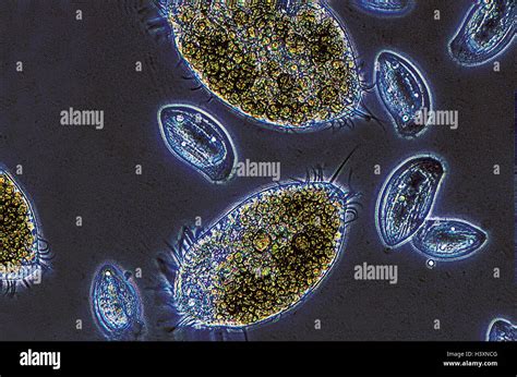 Oxytricha! Un Prédateur Microscopique Qui Nage Et Chasse Dans La Boue !