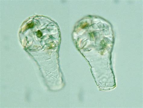 Quel est le Quadrulella symmetrica? Un microbe fascinant qui vit dans la litière des forêts tropicales!