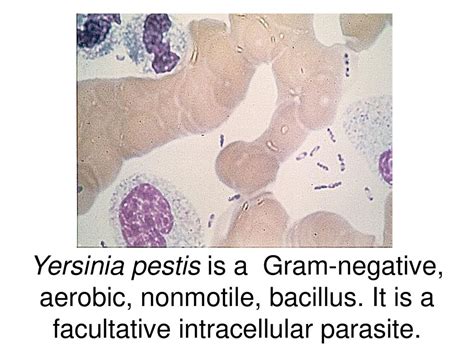  Yersinia Pestis: Un petit parasite qui peut causer de grands problèmes, un véritable maître du camouflage!